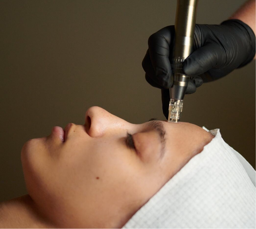 Microneedling - Courses