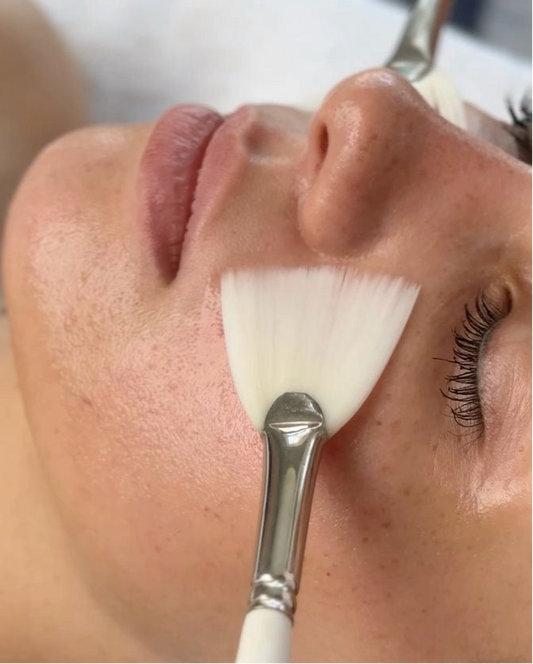 Mesotherapy Facial